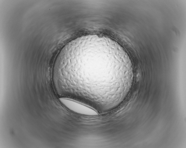 X0000115161156200911101744