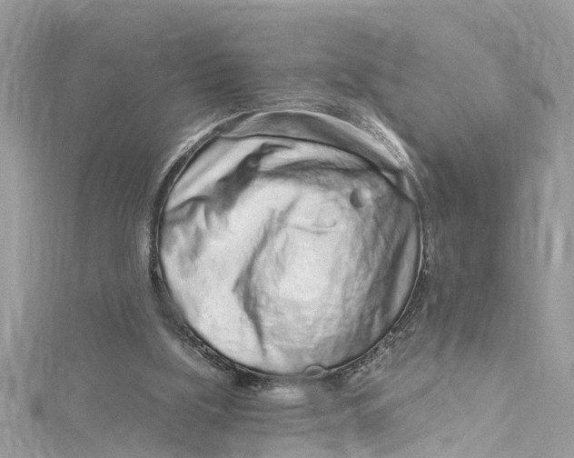 X0000115160059200911171310