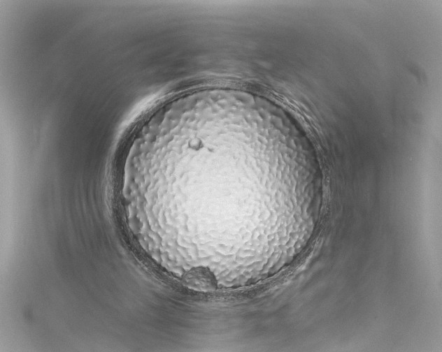 X0000115160149200911171308