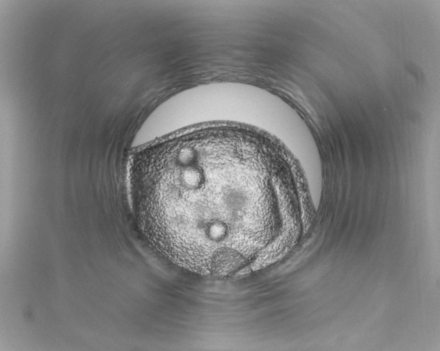 X0000115160285200911171308