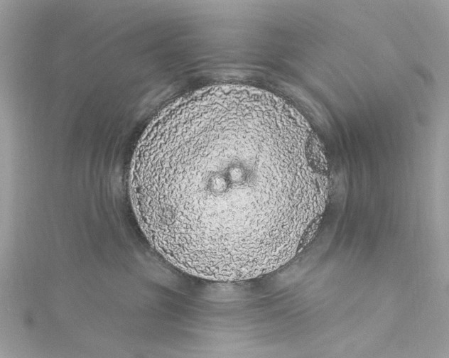 X0000115160381200911171306