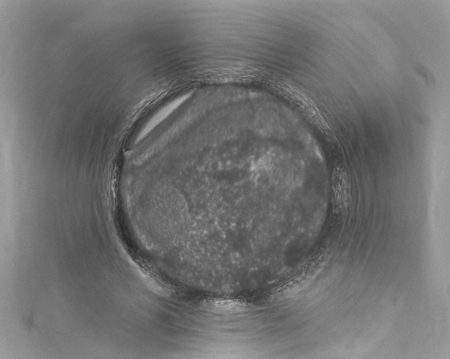 X0000115160590200911171303