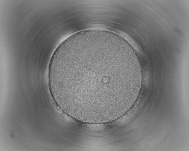 X0000115160856200911171300