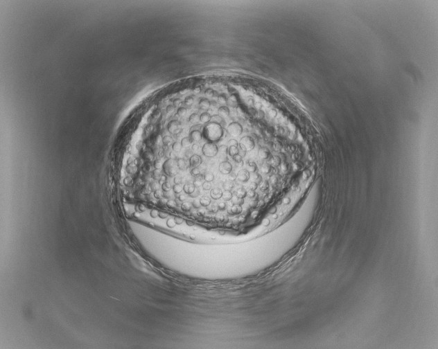 X0000115161400200911171252