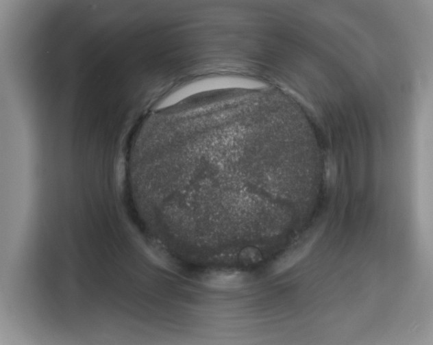 X0000115160206200911241555