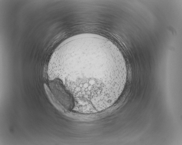 X0000115160044200912081417