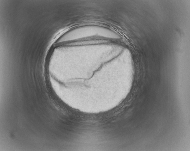 X0000115160104200912081416