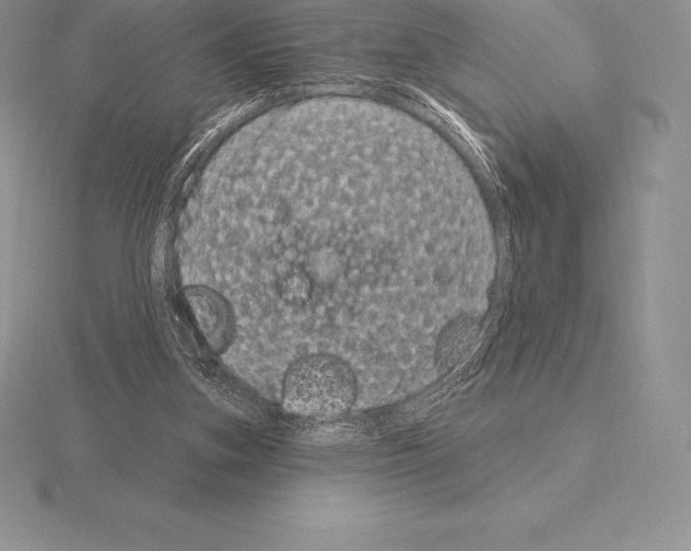 X0000115160155200912081415