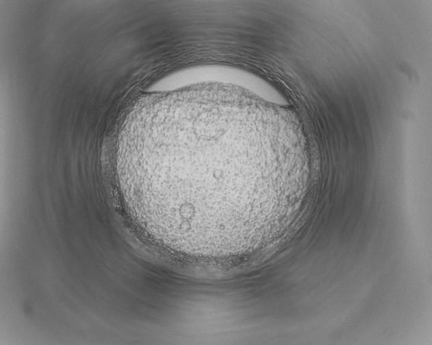 X0000115160175200912081415