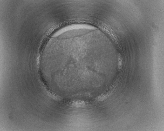 X0000115160206200912081415