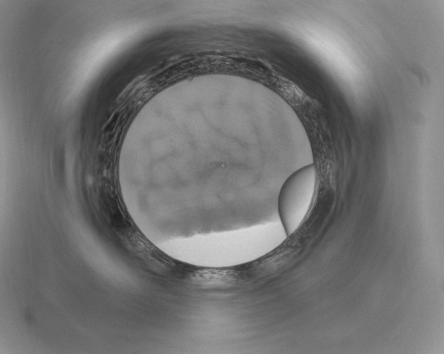 X0000115160526200912081411