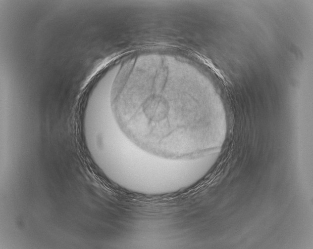 X0000115161256200912081400