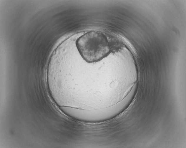 X0000115161436200912081358