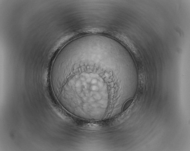 X0000115170159200911121747