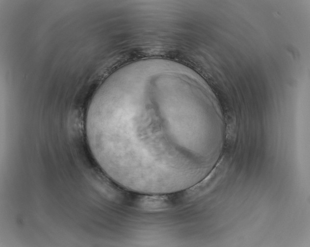 X0000115170179200911121747