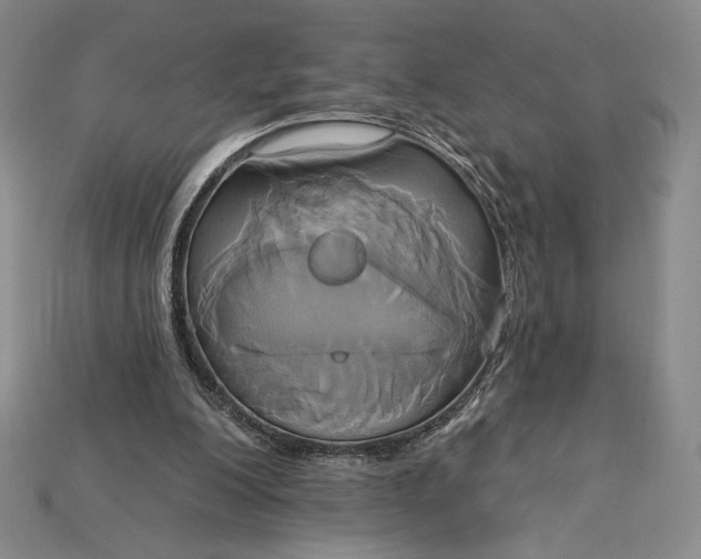 X0000115170200200911121746