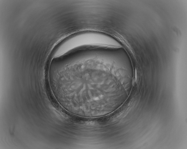 X0000115170204200911121746