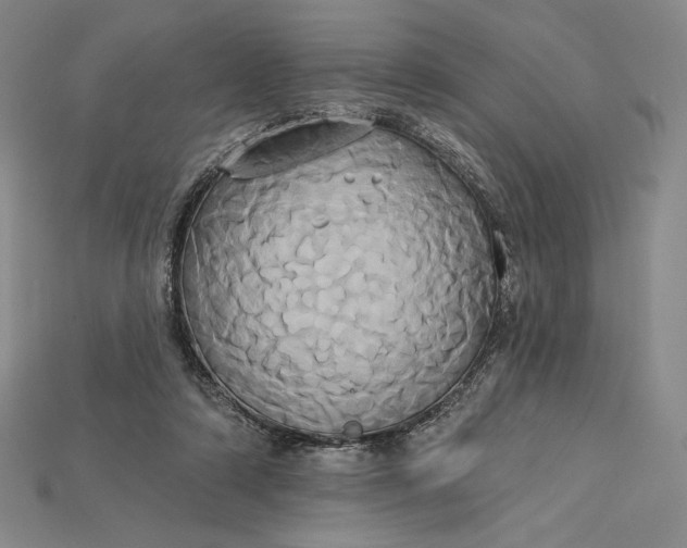 X0000115170306200911121745