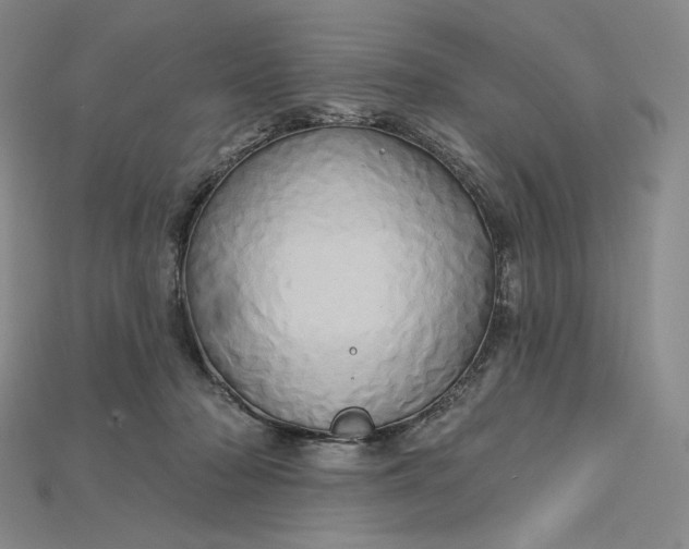 X0000115170318200911121745