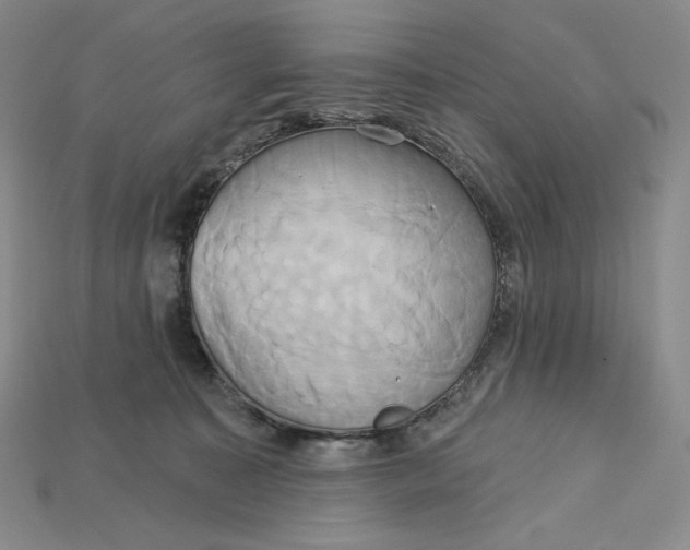 X0000115170323200911121745