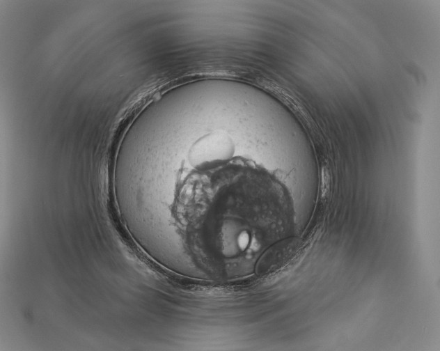 X0000115170349200911121744
