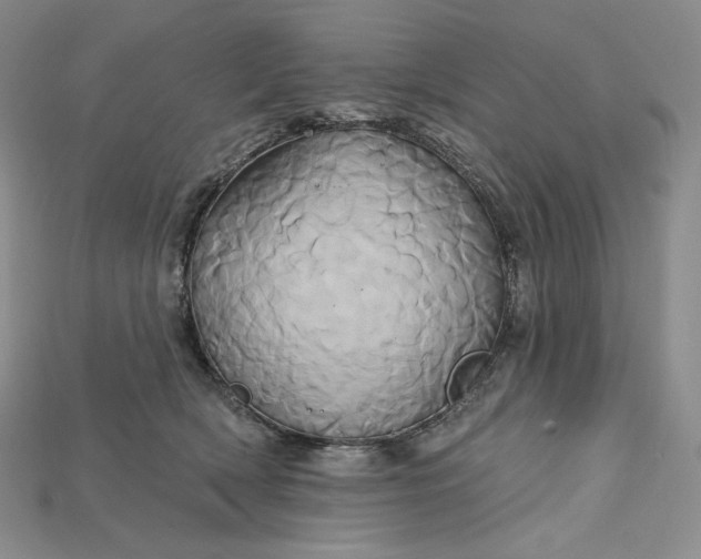 X0000115170418200911121744