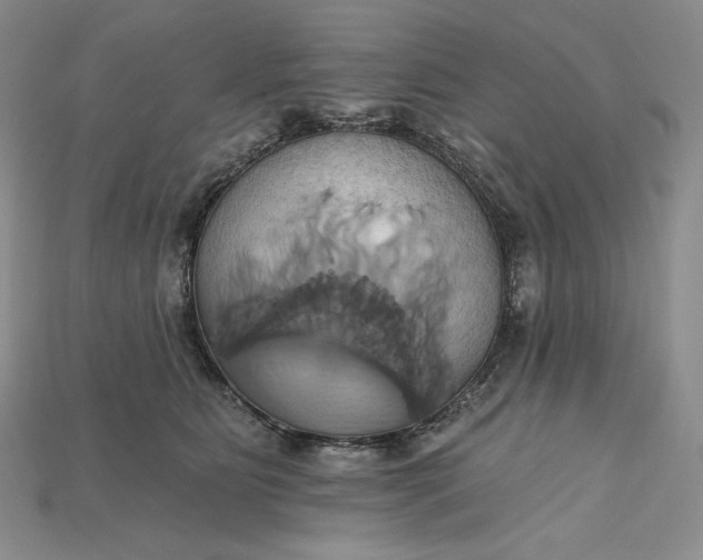 X0000115170515200911121742