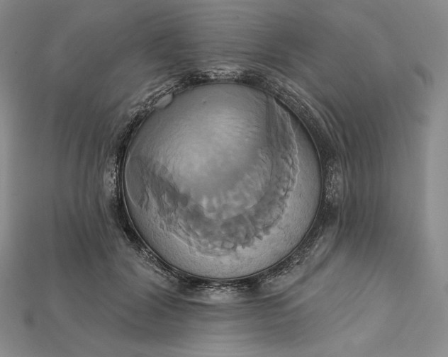 X0000115170604200911121741