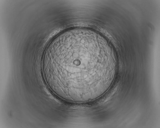 X0000115170625200911121740