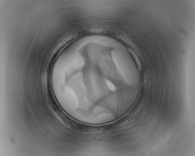 X0000115170626200911121740