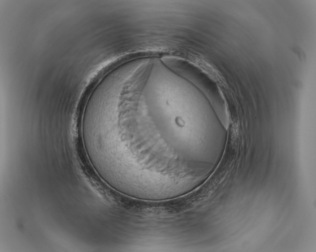 X0000115170628200911121740