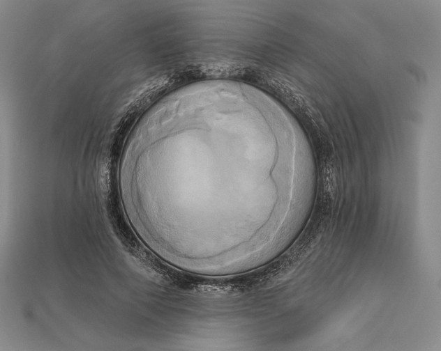 X0000115170690200911121740