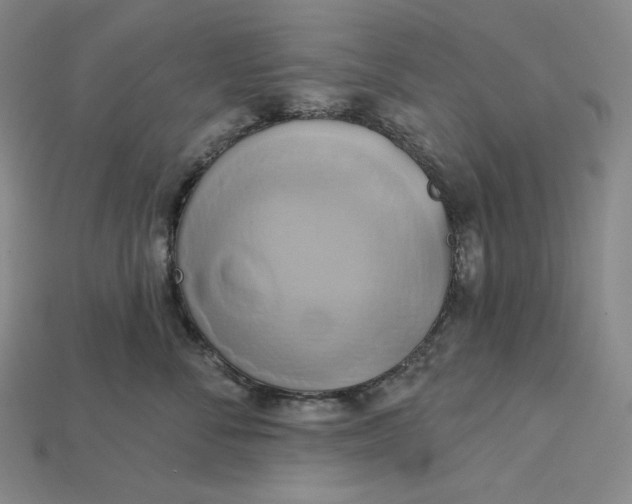 X0000115170716200911121739