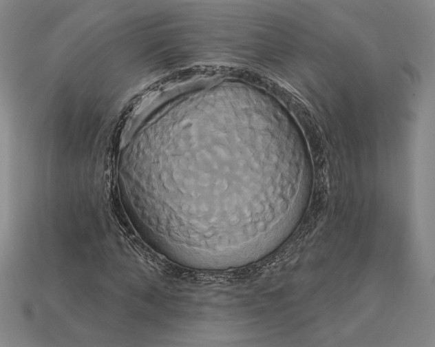 X0000115170870200911121737