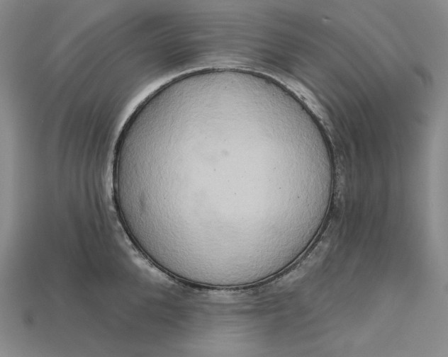 X0000115170904200911121737