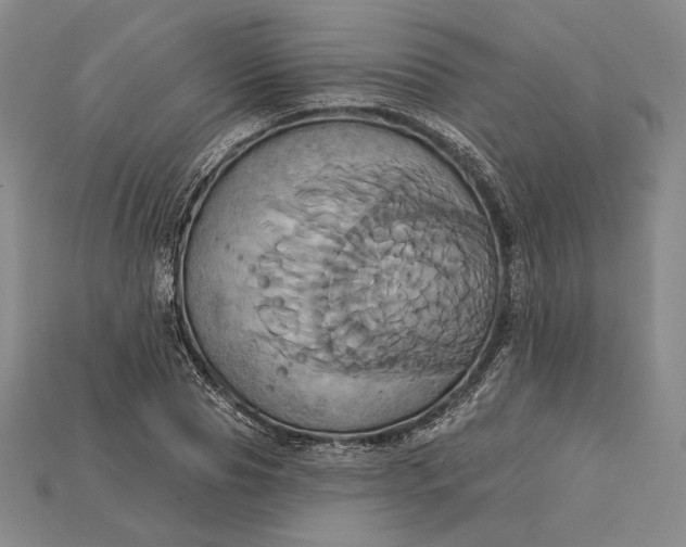 X0000115170929200911121736