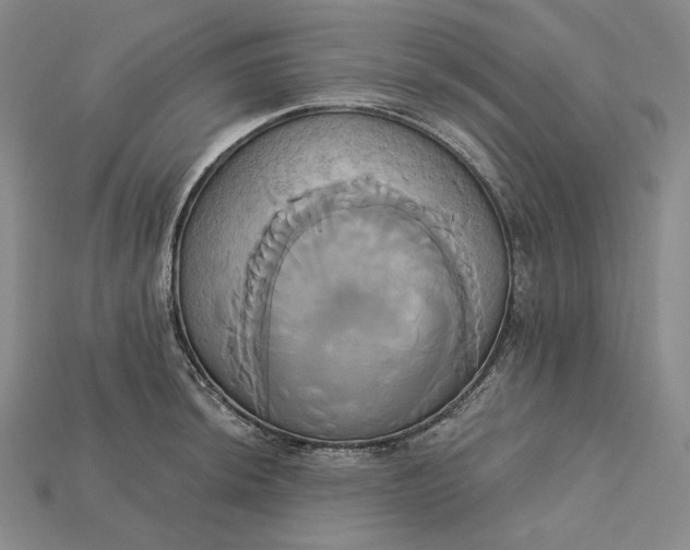 X0000115171044200911121735