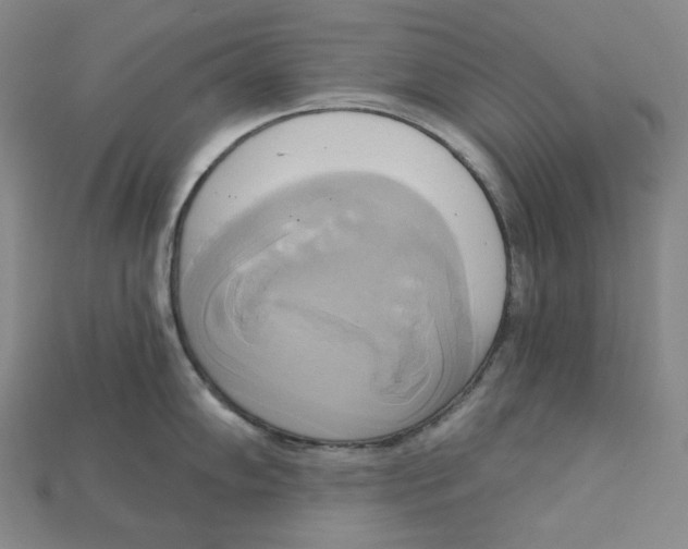 X0000115171102200911121734