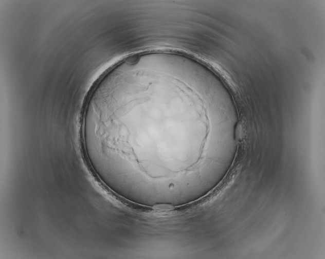 X0000115171134200911121734