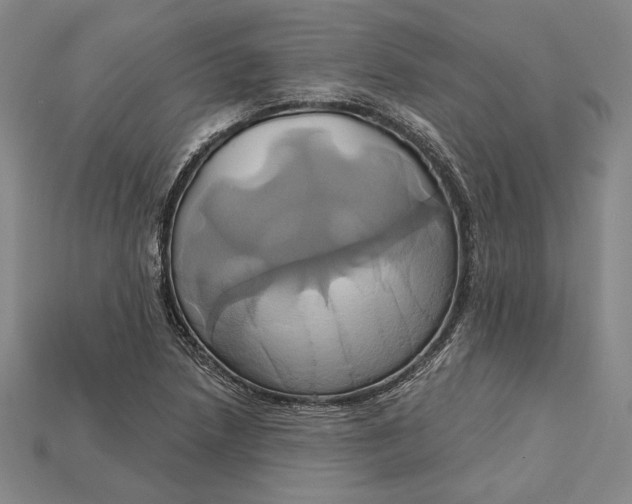 X0000115171218200911121732