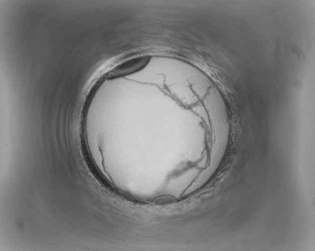 X0000115170007200911181416