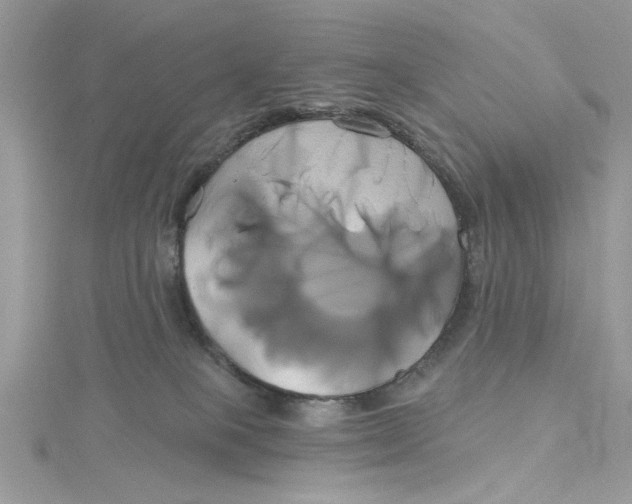 X0000115170085200911181415