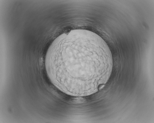 X0000115170087200911181415