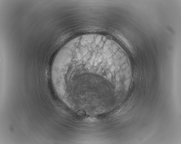 X0000115170119200911181414