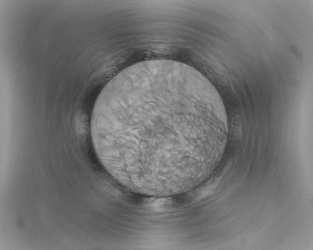 X0000115170135200911181414