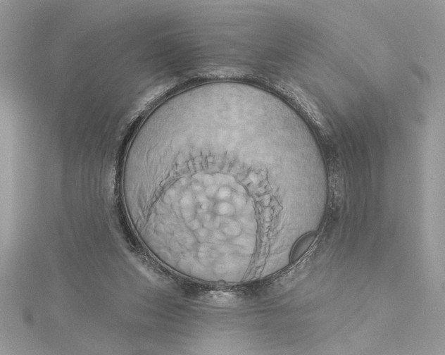 X0000115170159200911181413