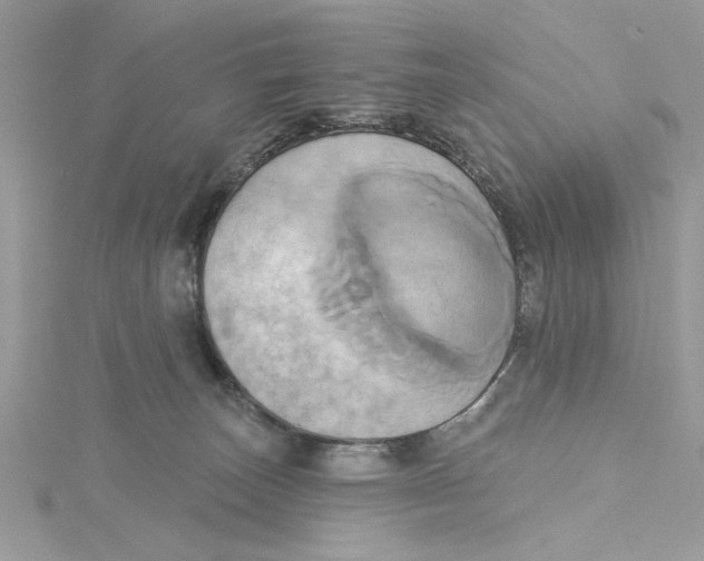 X0000115170179200911181414