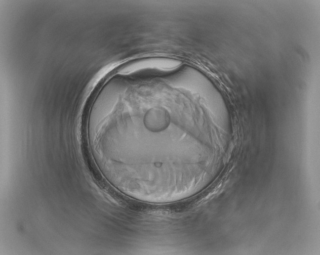 X0000115170200200911181413