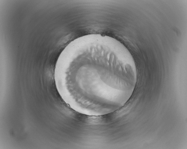 X0000115170240200911181412