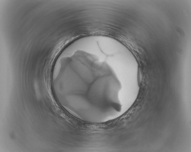 X0000115170241200911181412